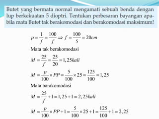 1 100 100
20
5
Mata tak berakomodasi
25 25
1,25
20
5 125
25 1,25
100 100 100
Mata barakomodasi
25
1 1,25 1 2,25
5 125
1 25 1 1 2,25
100 100 100
p f cm
f f
M kali
f
p
M PP
M kali
f
p
M PP
    
  
     
    
        
 