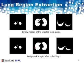 16 
Binary images of the selected lung region 
Lung mask images after hole filling 
 