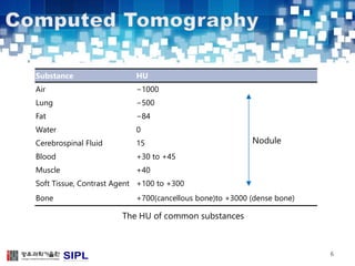 6 
Substance HU 
Air −1000 
Lung −500 
Fat −84 
Water 0 
Cerebrospinal Fluid 15 
Blood +30 to +45 
Muscle +40 
Soft Tissue, Contrast Agent +100 to +300 
Bone +700(cancellous bone)to +3000 (dense bone) 
The HU of common substances 
Nodule 
 