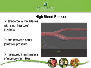 High Blood Pressure
 The force in the arteries
with each heartbeat
(systolic)

 and between beats
(diastolic pressure)

 measured in millimeters
of mercury (mm Hg).
 