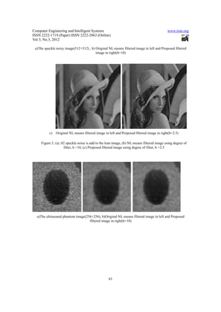 Computer Engineering and Intelligent Systems                                                www.iiste.org
ISSN 2222-1719 (Paper) ISSN 2222-2863 (Online)
Vol 3, No.3, 2012

 a)The speckle noisy image(512×512) , b) Original NL-means filtered image in left and Proposed filtered
                                         image in right(h=10)




          c)   Original NL-means filtered image in left and Proposed filtered image in right(h=2.5)

     Figure 3. (a) .02 speckle noise is add to the lean image, (b) NL-means filtered image using degree of
                     filter, h =10, (c) Proposed filtered image using degree of filter, h =2.5




  a)The ultrasound phantom image(256×256), b)Original NL-means filtered image in left and Proposed
                                   filtered image in right(h=10)




                                                   61
 