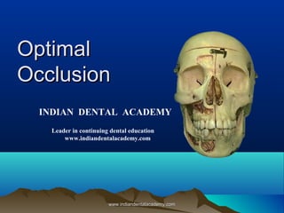 OptimalOptimal
OcclusionOcclusion
INDIAN DENTAL ACADEMY
Leader in continuing dental education
www.indiandentalacademy.com
www.indiandentalacademy.comwww.indiandentalacademy.com
 