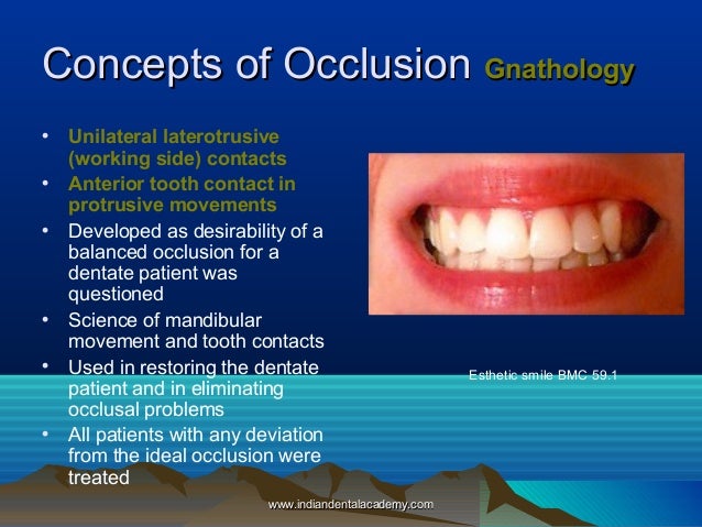 occlusion and occlusal indicating materials Occlusion and your bite occlusion the pankey splint is a flat plane splint made from a tooth colored acrylic resin material the occlusal scheme is created. occlusion and occlusal indicating materials Occlusion and your bite occlusion the pankey splint is a flat plane splint made from a tooth colored acrylic resin material the occlusal scheme is created.