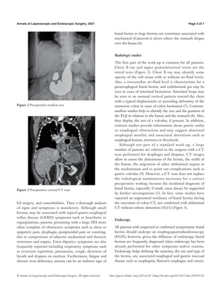 Optimal workup for a hiatal hernia.pdf
