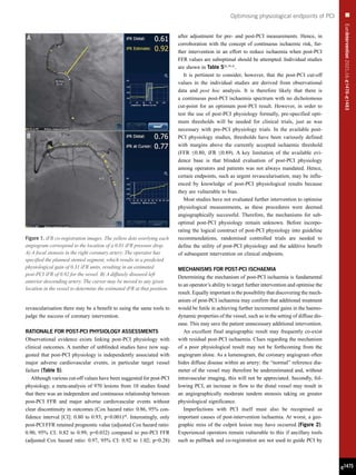 EuroIntervention
2021;16:
e
1470-
e
1483
e1475
Optimising physiological endpoints of PCI
revascularisation there may be a benefit to using the same tools to
judge the success of coronary intervention.
RATIONALE FOR POST-PCI PHYSIOLOGY ASSESSMENTS
Observational evidence exists linking post-PCI physiology with
clinical outcomes. A number of unblinded studies have now sug-
gested that post-PCI physiology is independently associated with
major adverse cardiovascular events, in particular target vessel
failure (Table 5).
Although various cut-off values have been suggested for post-PCI
physiology, a meta-analysis of 970 lesions from 10 studies found
that there was an independent and continuous relationship between
post-PCI FFR and major adverse cardiovascular events without
clear discontinuity in outcomes (Cox hazard ratio: 0.86, 95% con-
fidence interval [CI]: 0.80 to 0.93; p0.001)38
. Interestingly, only
post-PCI FFR retained prognostic value (adjusted Cox hazard ratio:
0.90, 95% CI: 0.82 to 0.99; p=0.032) compared to pre-PCI FFR
(adjusted Cox hazard ratio: 0.97, 95% CI: 0.92 to 1.02; p=0.28)
after adjustment for pre- and post-PCI measurements. Hence, in
corroboration with the concept of continuous ischaemic risk, fur-
ther intervention in an effort to reduce ischaemia when post-PCI
FFR values are suboptimal should be attempted. Individual studies
are shown in Table 536,39-41
.
It is pertinent to consider, however, that the post-PCI cut-off
values in the individual studies are derived from observational
data and post hoc analysis. It is therefore likely that there is
a continuous post-PCI ischaemia spectrum with no dichotomous
cut-point for an optimum post-PCI result. However, in order to
test the use of post-PCI physiology formally, pre-specified opti-
mum thresholds will be needed for clinical trials, just as was
necessary with pre-PCI physiology trials. In the available post-
PCI physiology studies, thresholds have been variously defined
with margins above the currently accepted ischaemic threshold
(FFR ≤0.80, iFR ≤0.89). A key limitation of the available evi-
dence base is that blinded evaluation of post-PCI physiology
among operators and patients was not always mandated. Hence,
certain endpoints, such as urgent revascularisation, may be influ-
enced by knowledge of post-PCI physiological results because
they are vulnerable to bias.
Most studies have not evaluated further intervention to optimise
physiological measurements, as these procedures were deemed
angiographically successful. Therefore, the mechanisms for sub-
optimal post-PCI physiology remain unknown. Before incorpo-
rating the logical construct of post-PCI physiology into guideline
recommendations, randomised controlled trials are needed to
define the utility of post-PCI physiology and the additive benefit
of subsequent intervention on clinical endpoints.
MECHANISMS FOR POST-PCI ISCHAEMIA
Determining the mechanism of post-PCI ischaemia is fundamental
to an operator’s ability to target further intervention and optimise the
result. Equally important is the possibility that discovering the mech-
anism of post-PCI ischaemia may confirm that additional treatment
would be futile in achieving further incremental gains in the haemo-
dynamic properties of the vessel, such as in the setting of diffuse dis-
ease. This may save the patient unnecessary additional intervention.
An excellent final angiographic result may frequently co-exist
with residual post-PCI ischaemia. Clues regarding the mechanism
of a poor physiological result may not be forthcoming from the
angiogram alone. As a lumenogram, the coronary angiogram often
hides diffuse disease within an artery: the “normal” reference dia-
meter of the vessel may therefore be underestimated and, without
intravascular imaging, this will not be appreciated. Secondly, fol-
lowing PCI, an increase in flow to the distal vessel may result in
an angiographically moderate tandem stenosis taking on greater
physiological significance.
Imperfections with PCI itself must also be recognised as
important causes of post-intervention ischaemia. At worst, a geo-
graphic miss of the culprit lesion may have occurred (Figure 2).
Experienced operators remain vulnerable to this if ancillary tools
such as pullback and co-registration are not used to guide PCI by
Figure 1. iFR co-registration images. The yellow dots overlying each
angiogram correspond to the location of a 0.01 iFR pressure drop.
A) A focal stenosis in the right coronary artery. The operator has
specified the planned stented segment, which results in a predicted
physiological gain of 0.31 iFR units, resulting in an estimated
post-PCI iFR of 0.92 for the vessel. B) A diffusely diseased left
anterior descending artery. The cursor may be moved to any given
location in the vessel to determine the estimated iFR at that position.
 