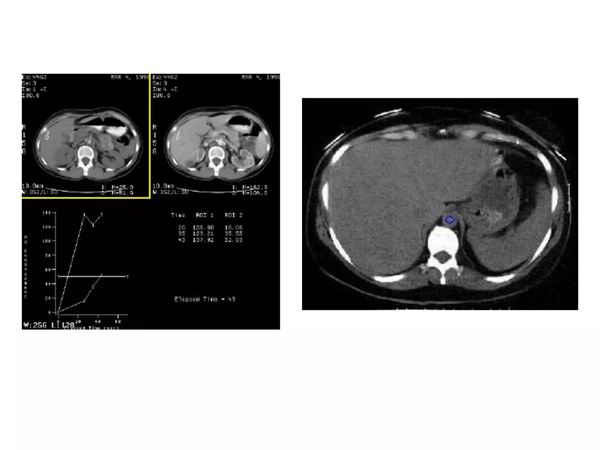 Optimization of ct scan protocol in acute abdomen 2003 revised aa | PPT