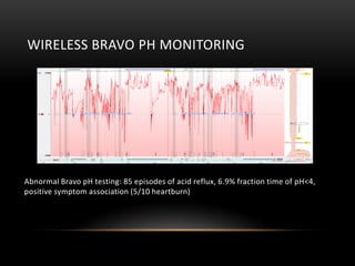 Optimize gerd management | PDF