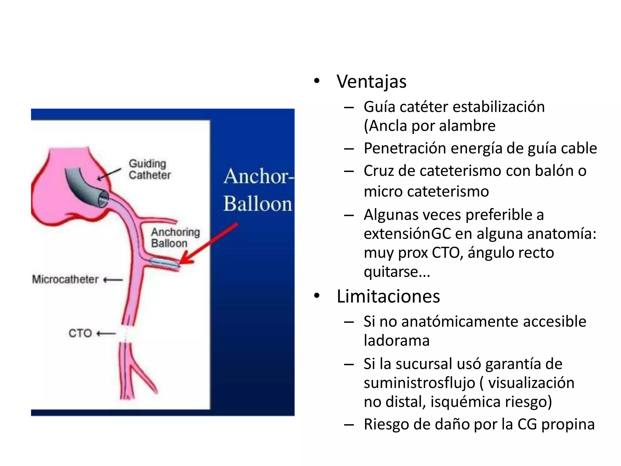 • Ventajas
– Guía catéter estabilización
(Ancla por alambre
– Penetración energía de guía cable
– Cruz de cateterismo con balón o
micro cateterismo
– Algunas veces preferible a
extensiónGC en alguna anatomía:
muy prox CTO, ángulo recto
quitarse...
• Limitaciones
– Si no anatómicamente accesible
ladorama
– Si la sucursal usó garantía de
suministrosflujo ( visualización
no distal, isquémica riesgo)
– Riesgo de daño por la CG propina
 