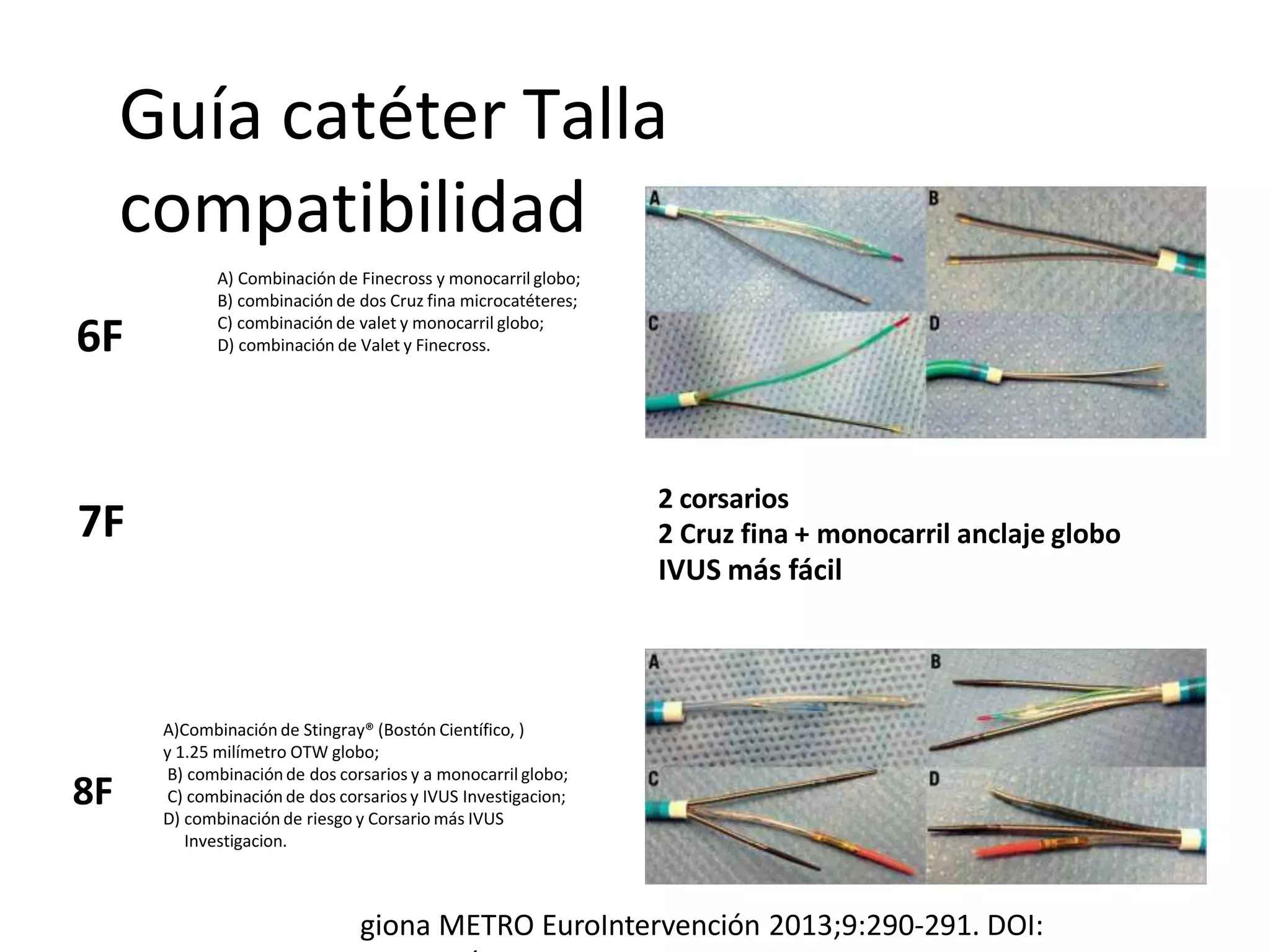 Guía catéter Talla
compatibilidad
2 corsarios
2 Cruz fina + monocarril anclaje globo
IVUS más fácil
A) Combinaciónde Finecross y monocarril globo;
B) combinación de dos Cruz fina microcatéteres;
C) combinación de valet y monocarril globo;
D) combinación de Valet y Finecross.
A)Combinación de Stingray® (Bostón Científico, )
y 1.25 milímetro OTW globo;
B) combinaciónde dos corsarios y a monocarril globo;
C) combinación de dos corsarios y IVUS Investigacion;
D) combinación de riesgo y Corsario más IVUS
Investigacion.
7F
8F
6F
giona METRO EuroIntervención 2013;9:290-291. DOI:
 