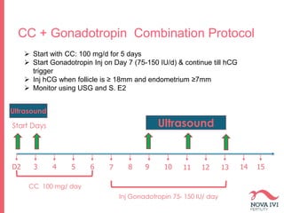 CC + Gonadotropin Combination Protocol
Ultrasound
D2 3 4 5 6 7 8 9 10 11 12 13 14 15
Start Days Ultrasound
 Start with CC: 100 mg/d for 5 days
 Start Gonadotropin Inj on Day 7 (75-150 IU/d) & continue till hCG
trigger
 Inj hCG when follicle is ≥ 18mm and endometrium ≥7mm
 Monitor using USG and S. E2
CC 100 mg/ day
Inj Gonadotropin 75- 150 IU/ day
 
