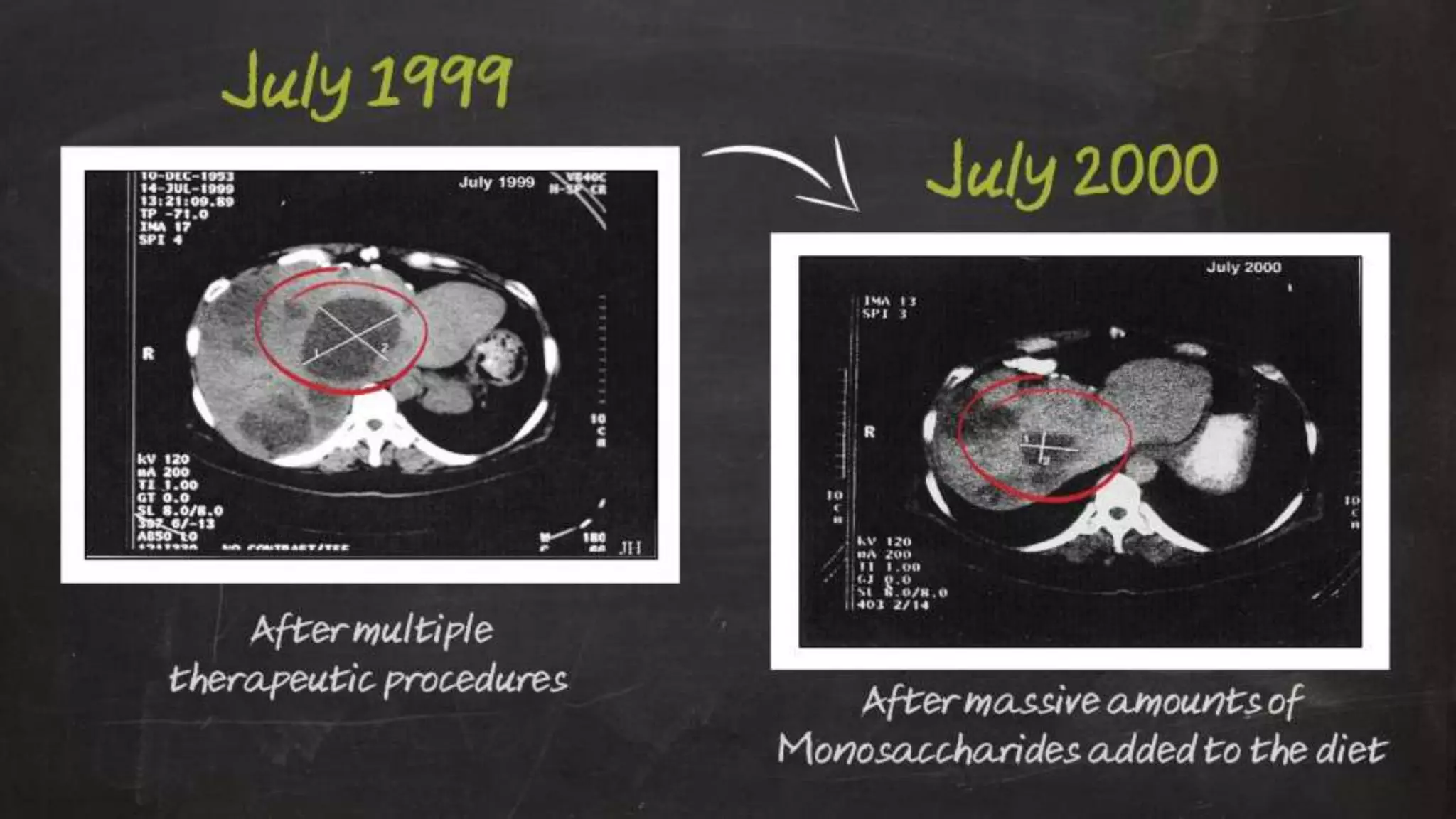 Optimizing Your Health Through Proper Nutrition & Exercise