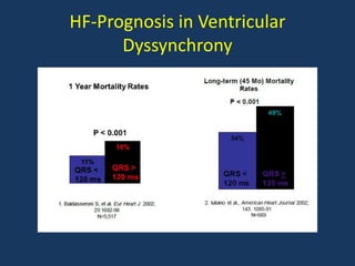 HF-Prognosis in Ventricular
Dyssynchrony
 