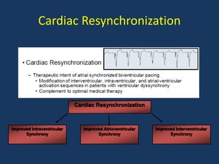 Cardiac Resynchronization
Cardiac Resynchronization
Improved Intraventricular
Synchrony
Improved Atrioventricular
Synchrony
Improved Interventricular
Synchrony
 