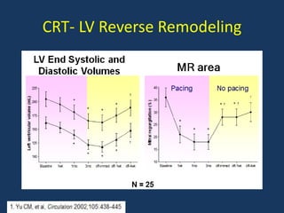 CRT- LV Reverse Remodeling
 