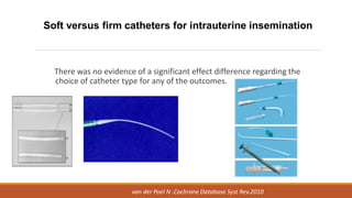 There was no evidence of a significant effect difference regarding the
choice of catheter type for any of the outcomes.
Soft versus firm catheters for intrauterine insemination
van der Poel N .Cochrane Database Syst Rev.2010
 