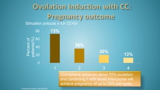 73%
36%
20%
13%
0
20
40
60
80
1 2 3 4
Percentof
patients(%)
Clomiphene achieves about 70% ovulation
and combining it with timed intercourse will
achieve pregnancy of up to 25% per cycle.
Homburg R.Hum Reprod. 2005;20(8):2043.
Stimulation protocols in IUI- CC+Gn
 