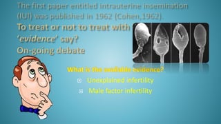  Unexplained infertility
 Male factor infertility
 