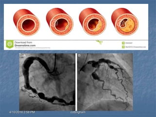 4/10/2016 2:58 PM cottingham
 