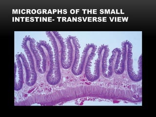 MICROGRAPHS OF THE SMALL
INTESTINE- TRANSVERSE VIEW
 