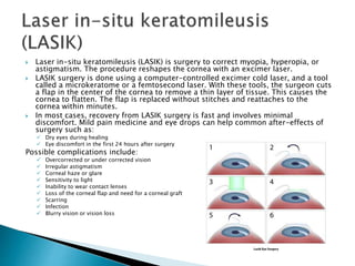  Laser in-situ keratomileusis (LASIK) is surgery to correct myopia, hyperopia, or
astigmatism. The procedure reshapes the cornea with an excimer laser.
 LASIK surgery is done using a computer-controlled excimer cold laser, and a tool
called a microkeratome or a femtosecond laser. With these tools, the surgeon cuts
a flap in the center of the cornea to remove a thin layer of tissue. This causes the
cornea to flatten. The flap is replaced without stitches and reattaches to the
cornea within minutes.
 In most cases, recovery from LASIK surgery is fast and involves minimal
discomfort. Mild pain medicine and eye drops can help common after-effects of
surgery such as:
 Dry eyes during healing
 Eye discomfort in the first 24 hours after surgery
Possible complications include:
 Overcorrected or under corrected vision
 Irregular astigmatism
 Corneal haze or glare
 Sensitivity to light
 Inability to wear contact lenses
 Loss of the corneal flap and need for a corneal graft
 Scarring
 Infection
 Blurry vision or vision loss
 