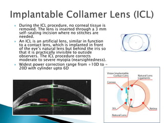  During the ICL procedure, no corneal tissue is
removed. The lens is inserted through a 3 mm
self-sealing incision where no stitches are
needed.
 An ICL is an artificial lens, similar in function
to a contact lens, which is implanted in front
of the eye’s natural lens but behind the iris so
that it is practically invisible to outside
observers. The ICL procedure corrects
moderate to severe myopia (nearsightedness).
 Widest power correction range from +10D to -
20D with cylinder upto 6D
 