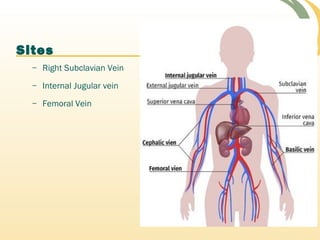 Sites
– Right Subclavian Vein
– Internal Jugular vein
– Femoral Vein
 