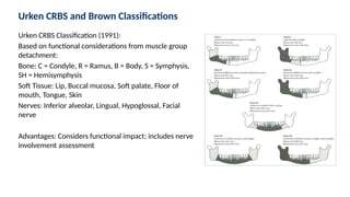 Brown Defect Classification Comprehensive Options for Mandibular Defect Reconstruction: Techniques ...