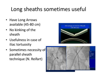 • Have Long Arrows
available (45-80 cm)
• No kinking of the
sheath
• Usefulness in case of
iliac tortuosity
• Sometimes necessity of
parallel sheath
technique (N. Reifart)
Long sheaths sometimes useful
 
