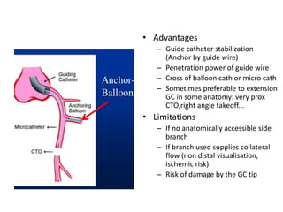 • Advantages
– Guide catheter stabilization
(Anchor by guide wire)
– Penetration power of guide wire
– Cross of balloon cath or micro cath
– Sometimes preferable to extension
GC in some anatomy: very prox
CTO,right angle takeoff...
• Limitations
– If no anatomically accessible side
branch
– If branch used supplies collateral
flow (non distal visualisation,
ischemic risk)
– Risk of damage by the GC tip
 