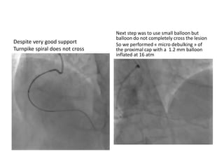 Despite very good support
Turnpike spiral does not cross
Next step was to use small balloon but
balloon do not completely cross the lesion
So we performed « micro debulking » of
the proximal cap with a 1.2 mm balloon
inflated at 16 atm
 