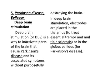 5. Parkinson disease,
Epilepsy
Deep brain
stimulation
Deep brain
stimulation (or DBS) is a
way to inactivate parts
of the brain that
cause Parkinson's
disease and its
associated symptoms
without purposefully
destroying the brain.
In deep brain
stimulation, electrodes
are placed in the
thalamus (to treat
essential tremor and mul
tiple sclerosis) or in the
globus pallidus (for
Parkinson's disease).
 