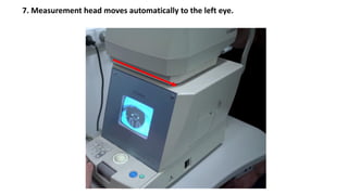 7. Measurement head moves automatically to the left eye.
 