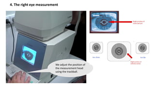 4. The right eye measurement
We adjust the position of
the measurement head
using the trackball.
 