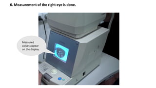 6. Measurement of the right eye is done.
Measured
values appear
on the display.
 