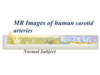 MR Images of human carotid
arteries
Normal Subject
 