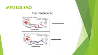METABOLISMO
Desmielização
 