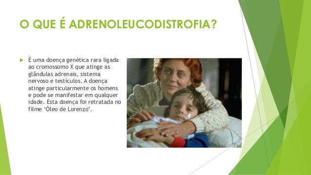 Adrenoleucodistrofia