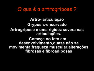 O que é a artrogripose ? ,[object Object],[object Object],[object Object],[object Object]