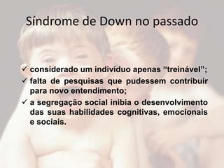 Síndrome de Down no passado


 considerado um indivíduo apenas “treinável”;
 falta de pesquisas que pudessem contribuir
  para novo entendimento;
 a segregação social inibia o desenvolvimento
  das suas habilidades cognitivas, emocionais
  e sociais.
 