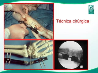 Técnica cirúrgica 