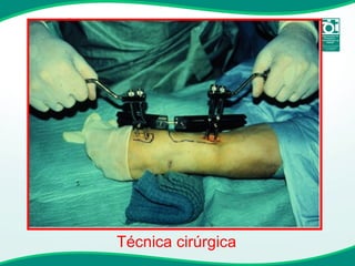 Técnica cirúrgica 