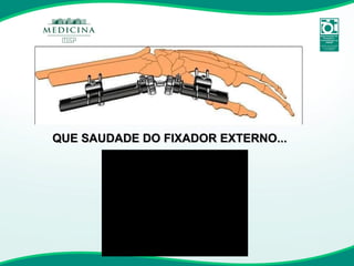QUE SAUDADE DO FIXADOR EXTERNO... 