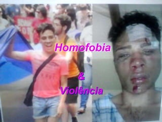 Homofobia
&
Violência
 