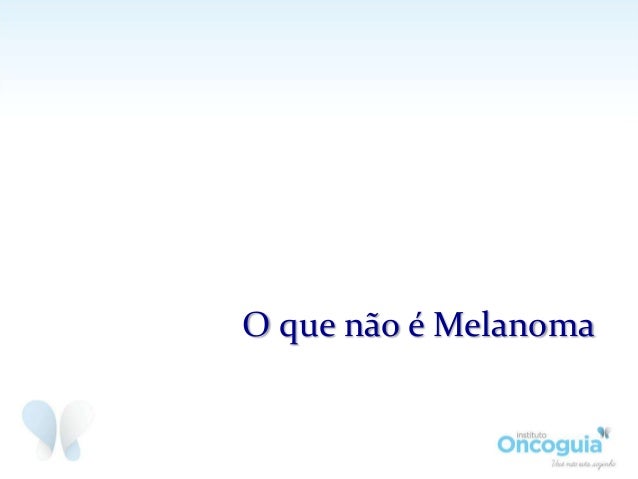 O que e swap no forex