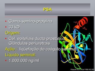 PSA Gama-semino-proteína 33 kD  Origem: Cél. epiteliais ducto prostático  Glândulas periuretrais Ação :   liqüefação do coágulo seminal Líquido seminal: 1.000.000 ng/ml Polascik et al.  J Urol  1999;162:293 