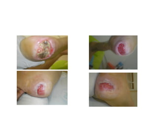 I.C




      Enfermeira Patrícia
      Coelho
 