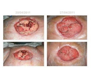 FOTOS DA LENA
  20/04/2011                         27/04/2011




               Enfermeira Patrícia
               Coelho
 