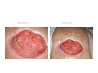 Fotos da Lena

           04/05/2011                     10/05/2011




17/04/12                Patricia Coelho
 