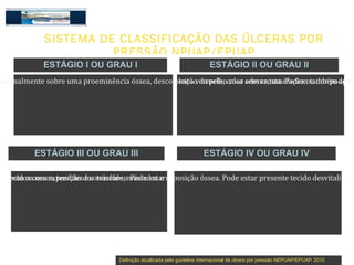 GRUPO DE PELE
             SISTEMA DE CLASSIFICAÇÃO DAS ÚLCERAS POR
                       PRESSÃO NPUAP/EPUAP
             ESTÁGIO I OU GRAU I                                          ESTÁGIO II OU GRAU II
enormalmente como uma ferida superficial (rasa) com leito vermelhocalor sem crosta. Podem também apre
  se apresenta sobre uma proeminência óssea, descoloração da pele, rosa edema,tumefação ou dor podem




          ESTÁGIO III OU GRAU III                                      ESTÁGIO IV OU GRAU IV

os tecidos com exposição dosmúsculos. Pode estarexposiçãoalgum tecidoestar presente (fibrina úmida). Pod
exposto os ossos, tendões ou tendões, músculos e presente óssea. Pode desvitalizado tecido desvitalizado




                                   Definição atualizada pelo guideline internacional de úlcera por pressão NEPUAP/EPUAP. 2010
 