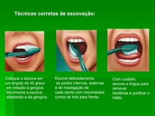 Técnicas corretas de escovação:  Coloque a escova em  um ângulo de 45 graus em relação à gengiva. Movimente a escova, afastando-a da gengiva. Escove delicadamente as partes internas, externas e de mastigação de cada dente com movimentos curtos de trás para frente. Com cuidado, escove a língua para remover bactérias e purificar o hálito. 